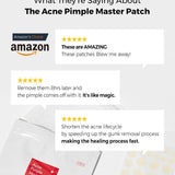 COSRX Acne Pimple Master Patch